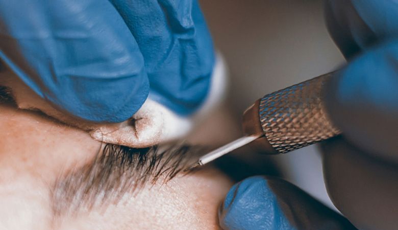 Microblading